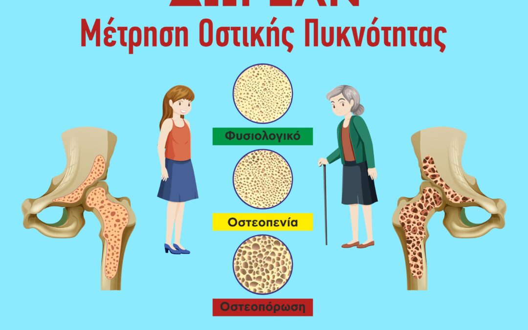Δράση Δωρεάν Μέτρησης Οστικής Πυκνότητας για τους Δημότες από 3 έως 7 Νοεμβρίου